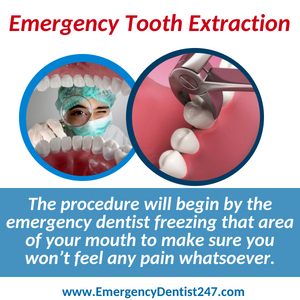 emergency tooth extraction seattle