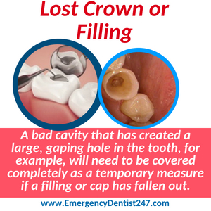 lost crown or filling denver