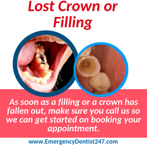 lost crown or filling louisville