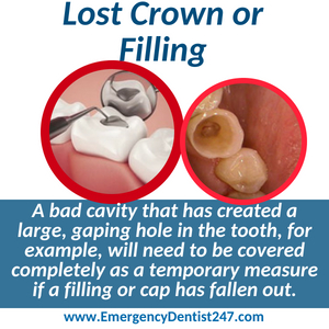 lost crown or filling nashville