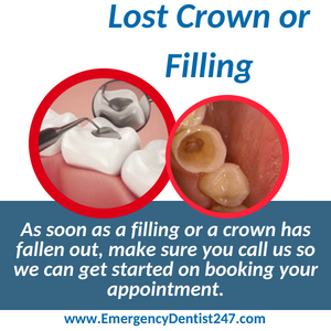 lost crown or filling seattle