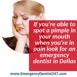 abscess tooth - emergency dentist 247 dallas