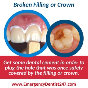 broken filling or crown - dental emergency 247 dallas