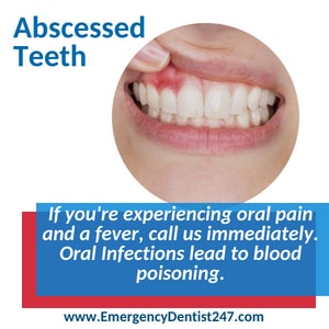 emergency dentist 247 brooklyn oral infections and abscessed teeth