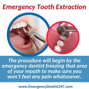 emergency dentist 247 brooklyn tooth extraction