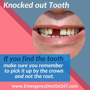 emergency dentist 247 brooklyn knocked out tooth