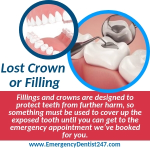 What to Do Over the Loss of a Filling or a Crown st. louis