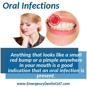 dealing with an oral infection st. louis