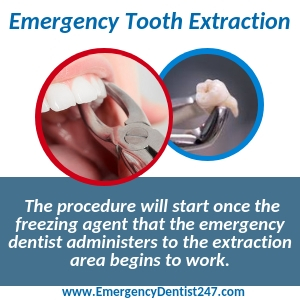 emergency tooth extraction new orleans