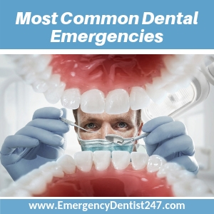 getting through the most common dental emergencies new orleans