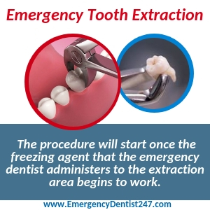 going through an emergency tooth extraction birmingham