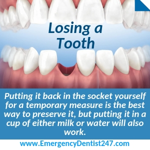 losing an adult tooth birmingham