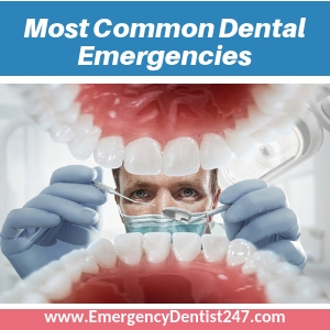 most common dental emergencies in oakland