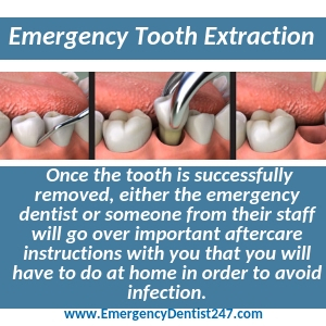 preparing for an emergency tooth extraction st. louis