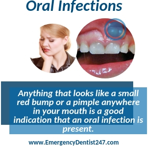suffering from an oral infection new orleans