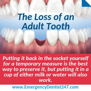 the loss of an adult tooth baton rouge