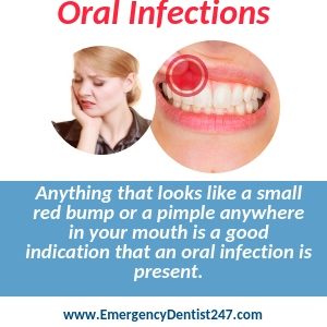 what to do when suffering with an oral infection birmingham