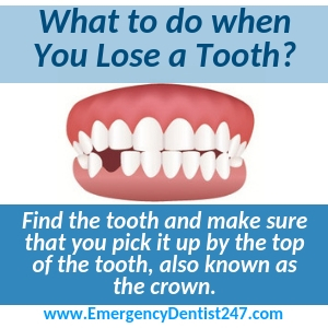 what to do when you lose a tooth new orleans