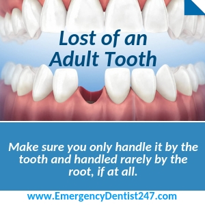 24/7 Emergency Dentist Cleveland, OH | Find 24/7 Emergency Dental Care