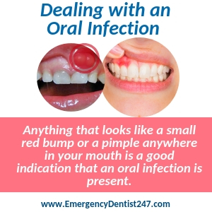 dealing with an oral infection memphis