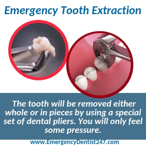 emergency tooth extraction fresno