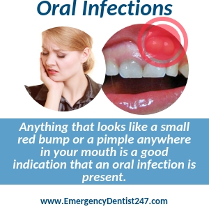 oral infections knoxville tn