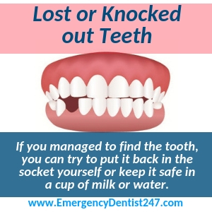 what to do when a tooth is knocked out los angeles