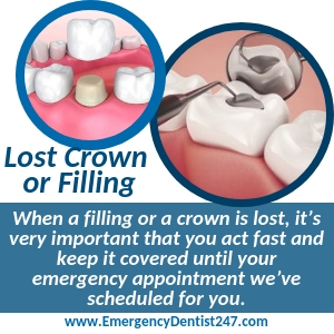 what to do when you lose a filling or a crown los angeles