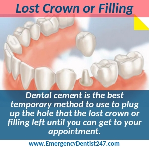lost fillings and crowns long island