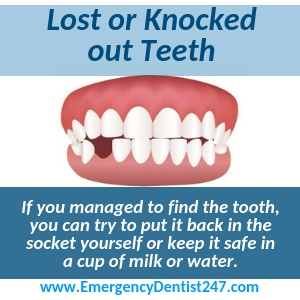 lost or knocked out teeth yonkers