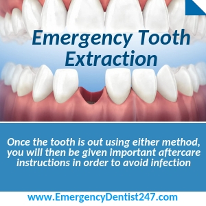 tooth extraction cincinnati