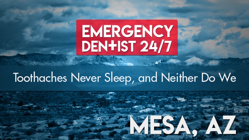 Emergency Dentist Mesa AZ Cover