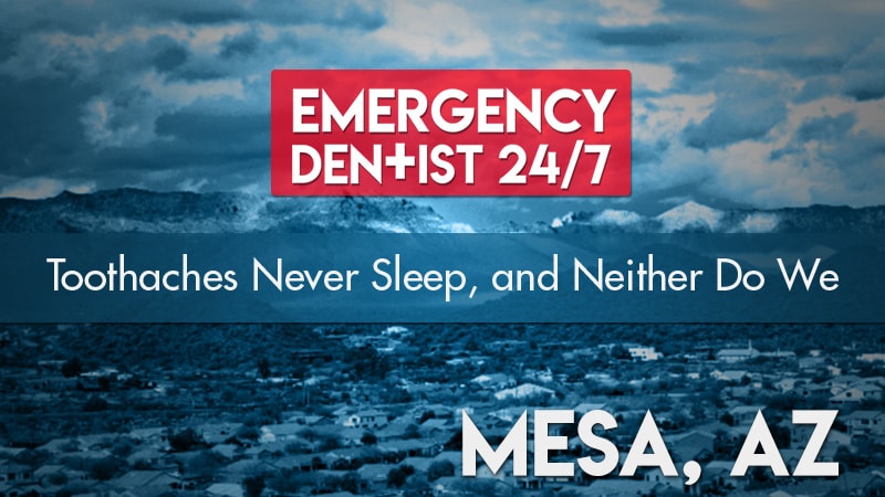 Emergency Dentist Mesa AZ Cover