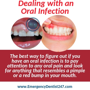 abscessed teeth infected gums and oral infections stockton ca