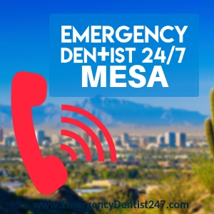 emergency dentist vs emergency room doctor mesa az