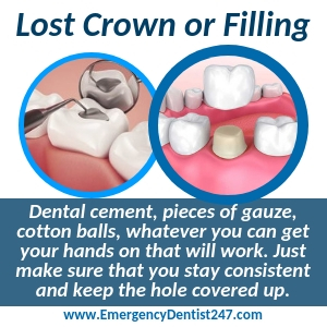 losing a filling or a crown albuquerque nm