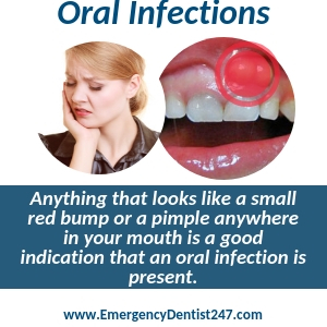 oral infections abscesses buffalo ny