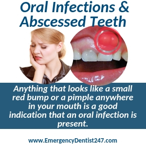 oral infections and abscessed teeth virginia beach