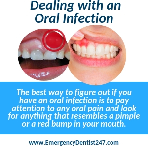 oral infections mesa az