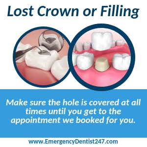 the loss of a filling or a crown miami