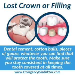 what to do about a lost filling or crown in newark