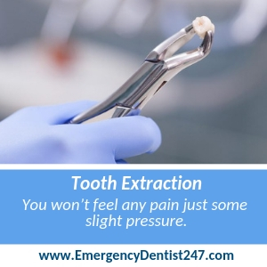 Emergency Tooth Extraction ORANGE CA