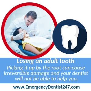 Losing an adult tooth union nj