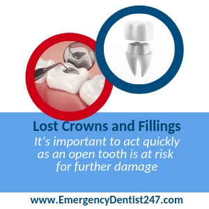 Lost Crowns and Fillings union nj