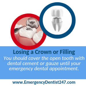 lost crowns and fillings omaha ne ed247